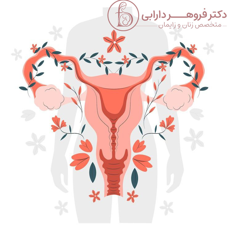 تشخیص سرطان دهانه رحم با پاپ اسمیر