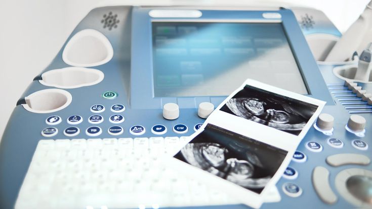 Things You Need To Know Before Buying Ultrasound Medical Equipment Succes Stuff