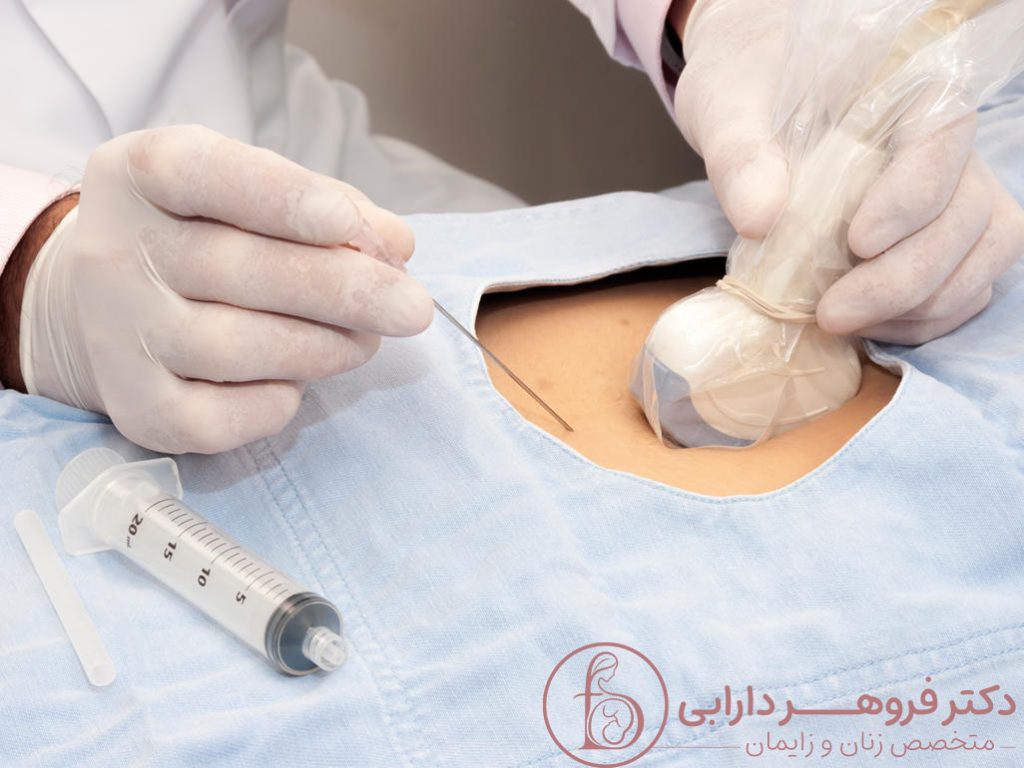 آزمایش آمنیوسنتز برای چیست